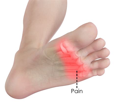 bottom of toe hurts when walking
